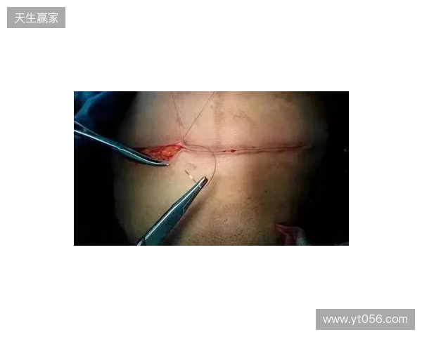 广州豹官方:杨浩眉弓伤口缝合30余针,预计5-7天后拆线 广州豹官方:杨浩眉弓伤口缝合30余针,预计5-7天后拆线